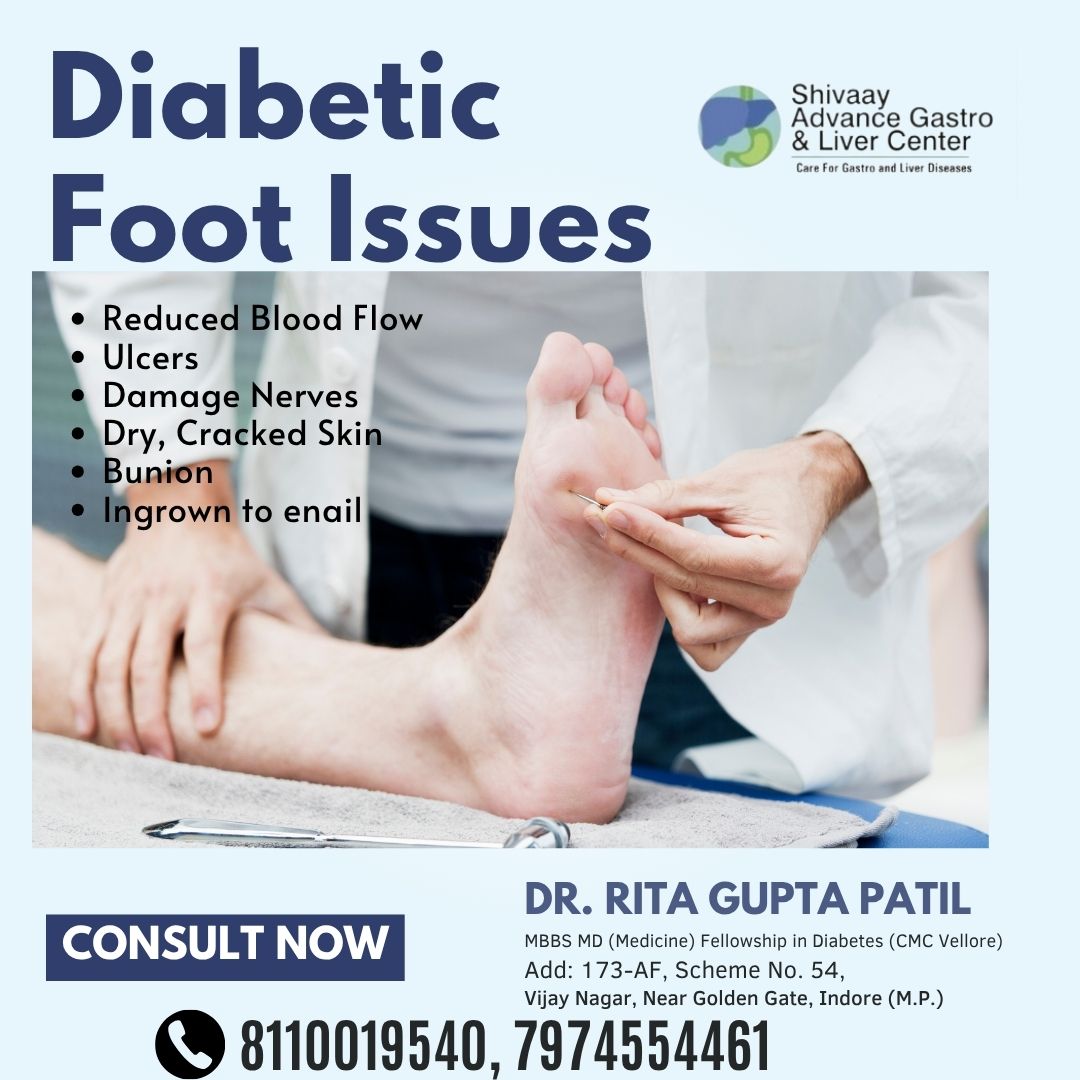 Best Doctor for Diabetic Foot Treatment in Indore